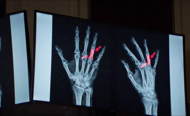 Анатомия падения (2023) в хорошем качестве скачать торрент файл Анатомия падения (2023) фильм в хорошем качестве скачать торрент файл