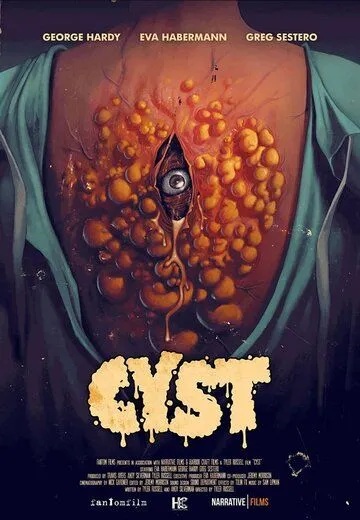 Киста / Cyst (2020) фильм скачать через торрет бесплатно в хорошем качестве