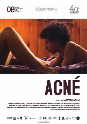 Угри / Acné (2008) фильм скачать через торрет бесплатно в хорошем качестве